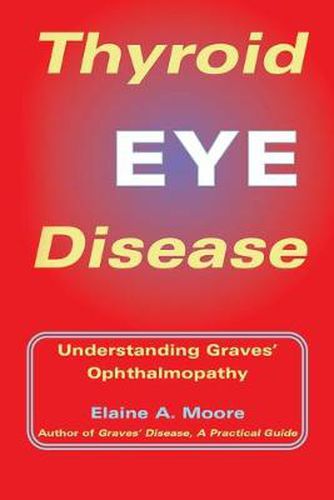 Cover image for Thyroid Eye Disease: Understanding Graves' Opthalmopathy