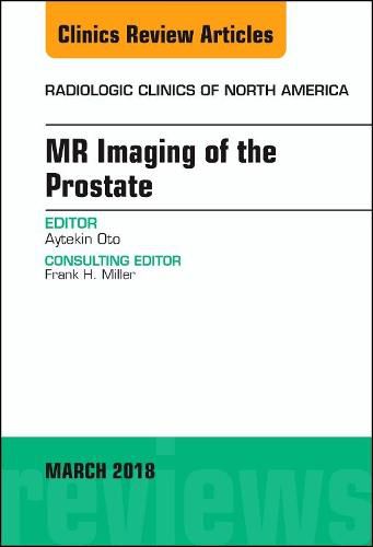 Cover image for MR Imaging of the Prostate, An Issue of Radiologic Clinics of North America