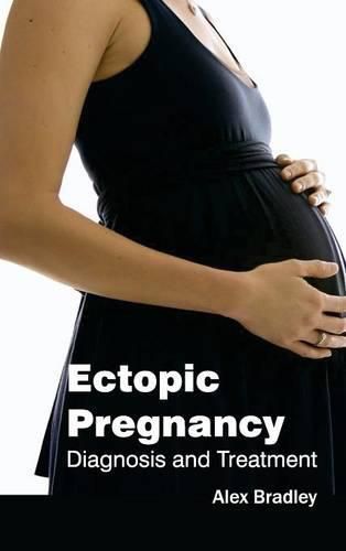 Cover image for Ectopic Pregnancy: Diagnosis and Treatment