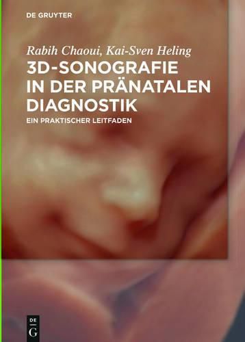 Cover image for 3D-Sonografie in der pranatalen Diagnostik