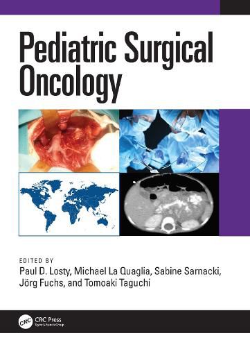 Cover image for Pediatric Surgical Oncology