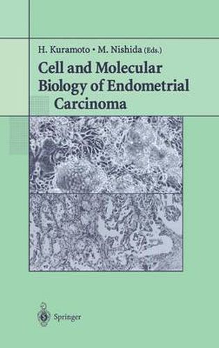 Cover image for Cell and Molecular Biology of Endometrial Carcinoma