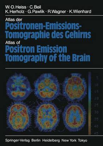 Cover image for Atlas der Positronen-Emissions-Tomographie des Gehirns / Atlas of Positron Emission Tomography of the Brain