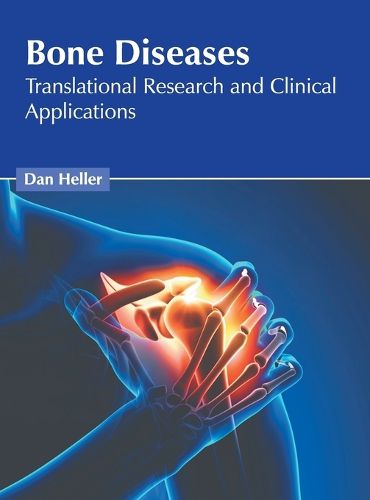 Cover image for Bone Diseases: Translational Research and Clinical Applications