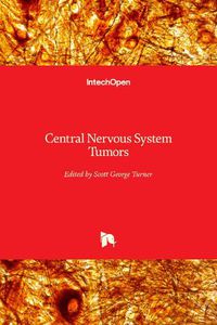 Cover image for Central Nervous System Tumors