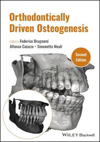 Cover image for Orthodontically Driven Osteogenesis