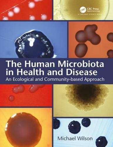 The Human Microbiota in Health and Disease: An Ecological and Community-Based Approach