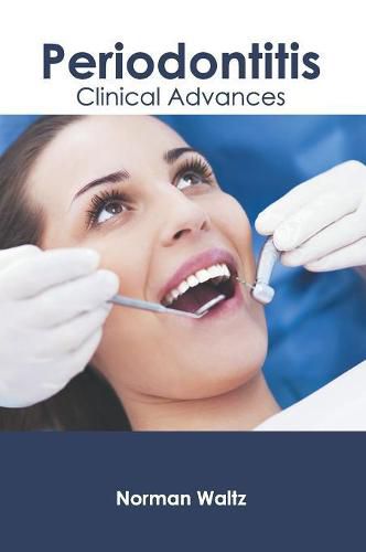 Cover image for Periodontitis: Clinical Advances