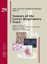 Cover image for Tumors of the Lower Respiratory Tract