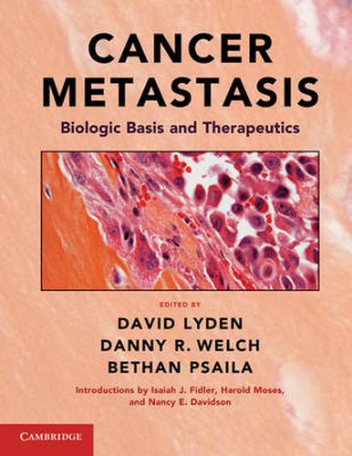 Cover image for Cancer Metastasis: Biologic Basis and Therapeutics