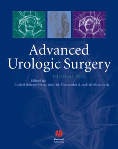 Cover image for Advanced Urologic Surgery