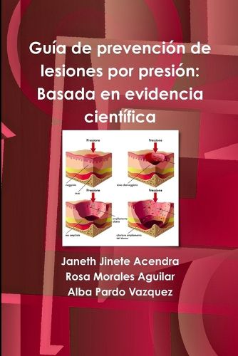 Cover image for Guia de prevencion de lesiones por presion