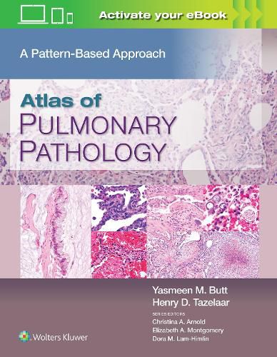 Cover image for Atlas of Pulmonary Pathology: A Pattern Based Approach