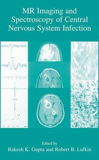 Cover image for MR Imaging and Spectroscopy of Central Nervous System Infection