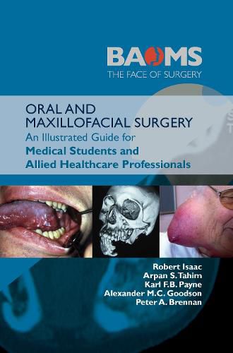 Cover image for ORAL AND MAXILLOFACIAL SURGERY: An Illustrated Guide for Medical Students and Allied Healthcare Professionals