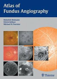 Cover image for Atlas of Fundus Angiography