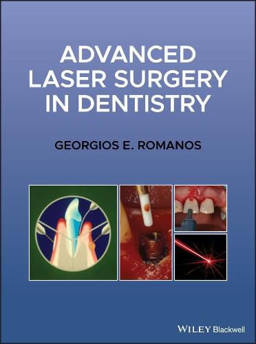 Cover image for Advanced Laser Surgery in Dentistry