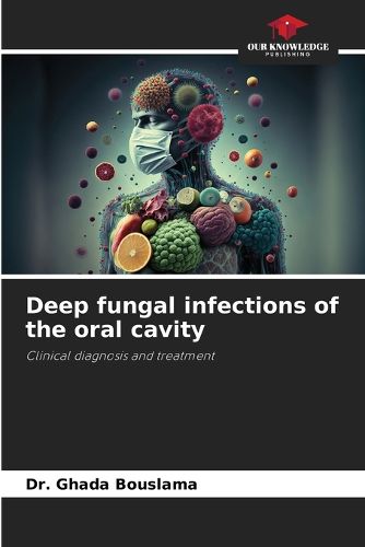 Cover image for Deep fungal infections of the oral cavity