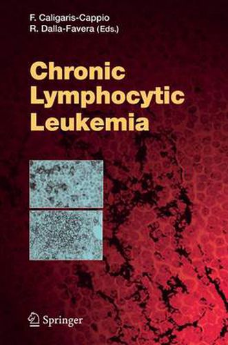 Cover image for Chronic Lymphocytic Leukemia