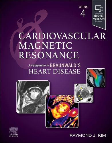 Cover image for Cardiovascular Magnetic Resonance