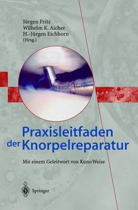 Cover image for Praxisleitfaden Der Knorpelreparatur