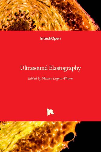 Cover image for Ultrasound Elastography