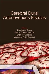 Cover image for Cerebral Dural Arteriovenous Fistulas