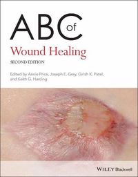 Cover image for ABC of Wound Healing 2nd Edition