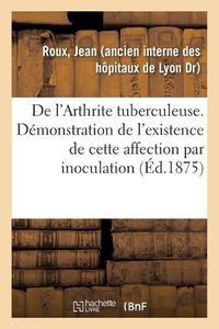 Cover image for de l'Arthrite Tuberculeuse. Demonstration de l'Existence de Cette Affection Par Inoculation: de Produits Synoviaux, Etude Accompagnee d'Observations Recueillies A l'Hotel-Dieu de Lyon