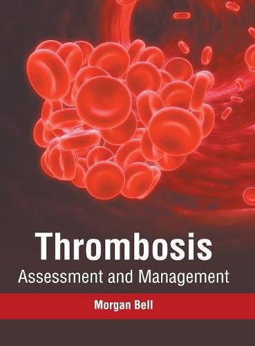 Cover image for Thrombosis: Assessment and Management