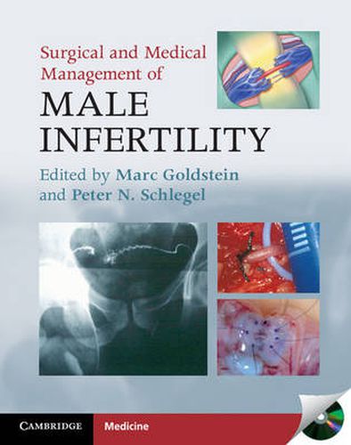 Cover image for Surgical and Medical Management of Male Infertility