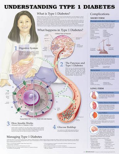 Cover image for Understanding Type 1 Diabetes Anatomical Chart