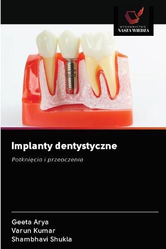 Cover image for Implanty dentystyczne