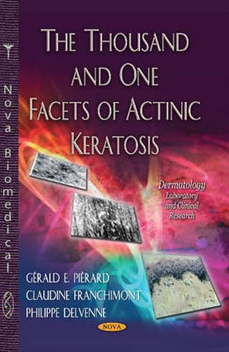 Cover image for Thousand & One Facets of Actinic Keratosis