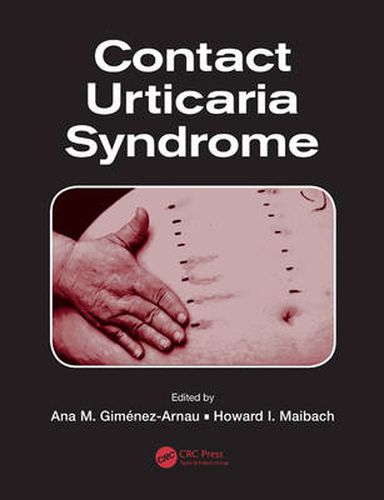 Cover image for Contact Urticaria Syndrome