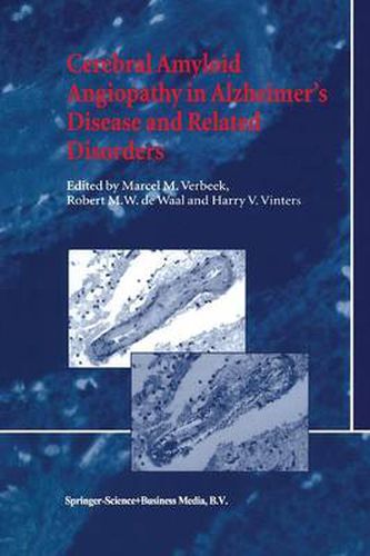 Cover image for Cerebral Amyloid Angiopathy in Alzheimer's Disease and Related Disorders