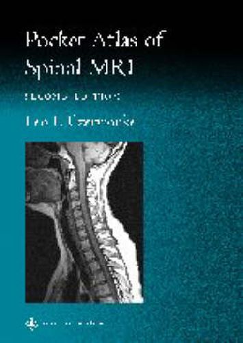 Cover image for Pocket Atlas of Spinal MRI