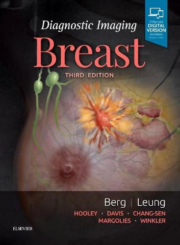 Cover image for Diagnostic Imaging: Breast