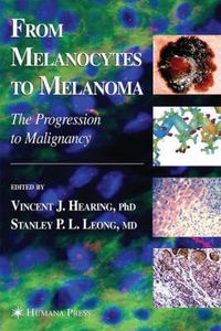 Cover image for From Melanocytes to Melanoma: The Progression to Malignancy