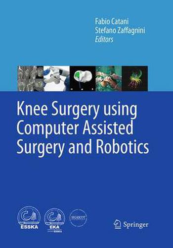 Cover image for Knee Surgery using Computer Assisted Surgery and Robotics