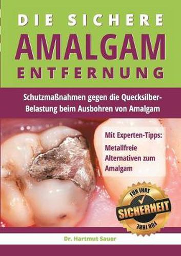 Cover image for Die sichere Amalgam-Entfernung: Schutzmassnahmen gegen die Quecksilber-Belastung beim Ausbohren von Amalgam