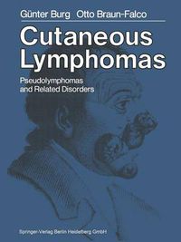 Cover image for Cutaneous Lymphomas, Pseudolymphomas, and Related Disorders