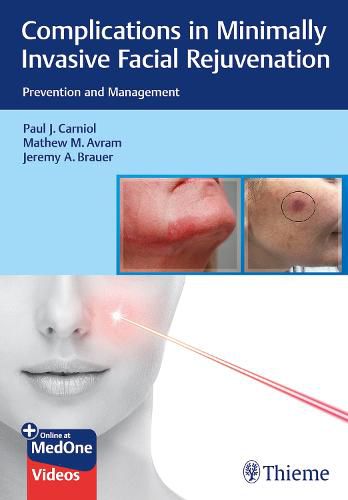 Complications in Minimally Invasive Facial Rejuvenation: Prevention and Management