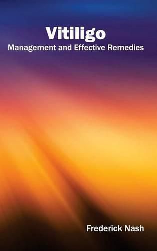 Cover image for Vitiligo: Management and Effective Remedies