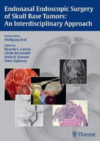 Cover image for Endonasal Endoscopic Surgery of Skull Base Tumors: An Interdisciplinary Approach