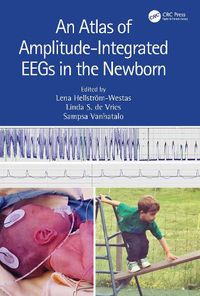 Cover image for An Atlas of Amplitude-Integrated EEGs in the Newborn