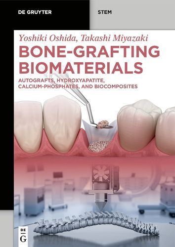 Cover image for Bone-Grafting Biomaterials