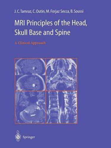 Cover image for MRI Principles of the Head, Skull Base and Spine: A Clinical Approach