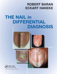 Cover image for Nail in Differential Diagnosis