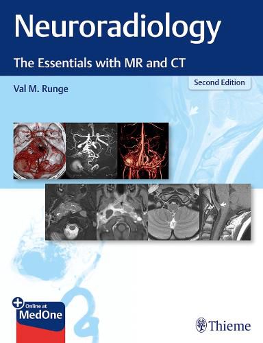 Cover image for Neuroradiology: The Essentials with MR and CT